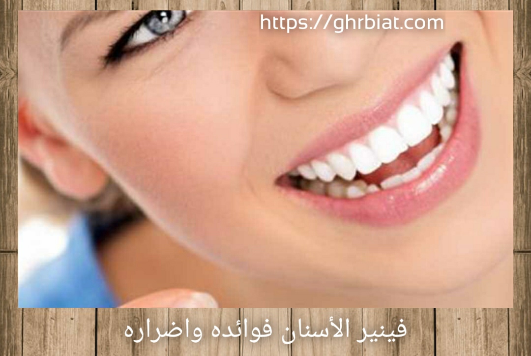 فينير الأسنان فوائده واضراره